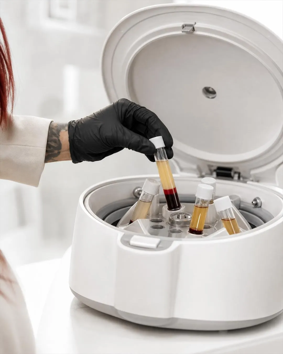 PRP Vampire Facial